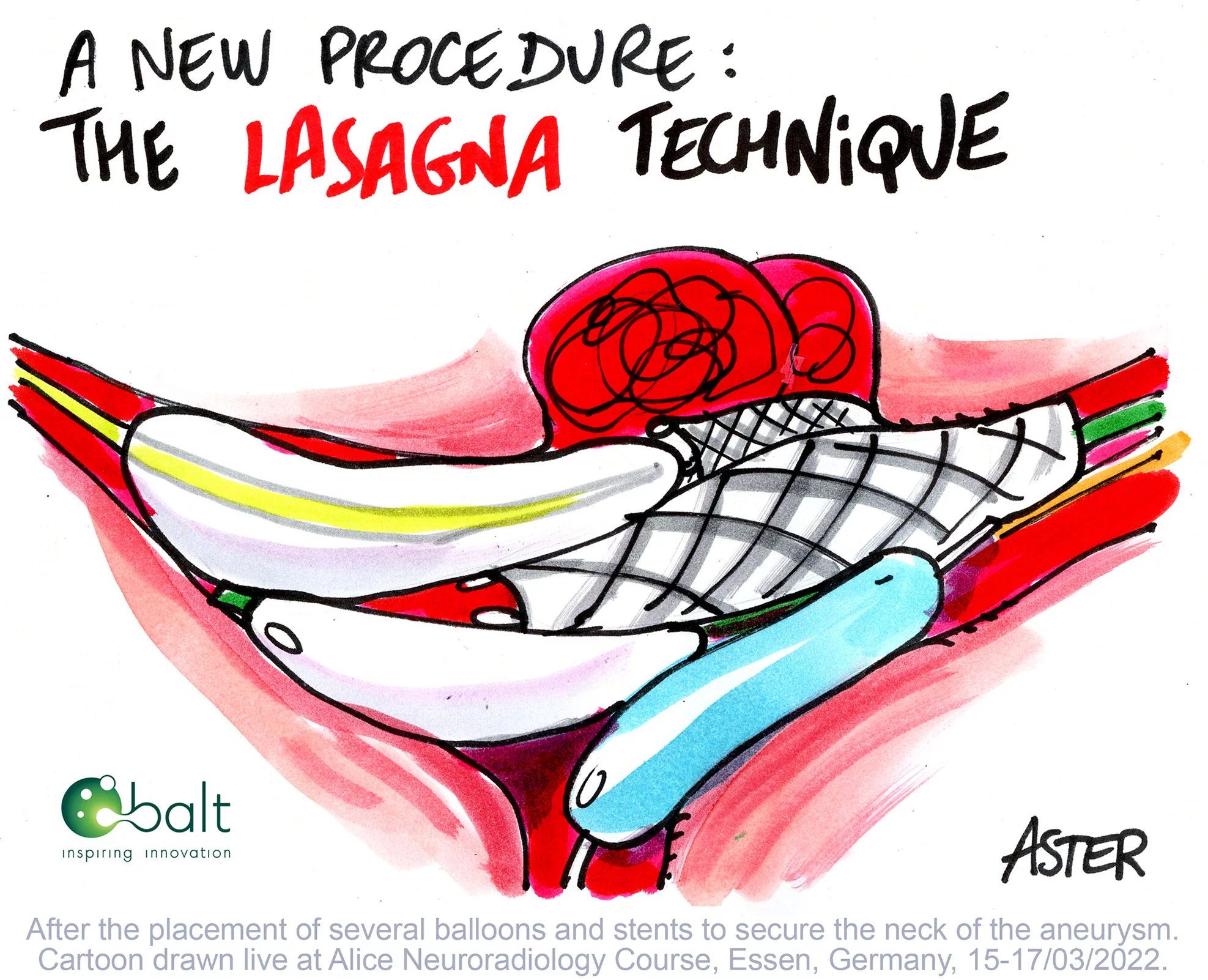 Dessin réalisé en direct lors du congrès médical ALICE 2022